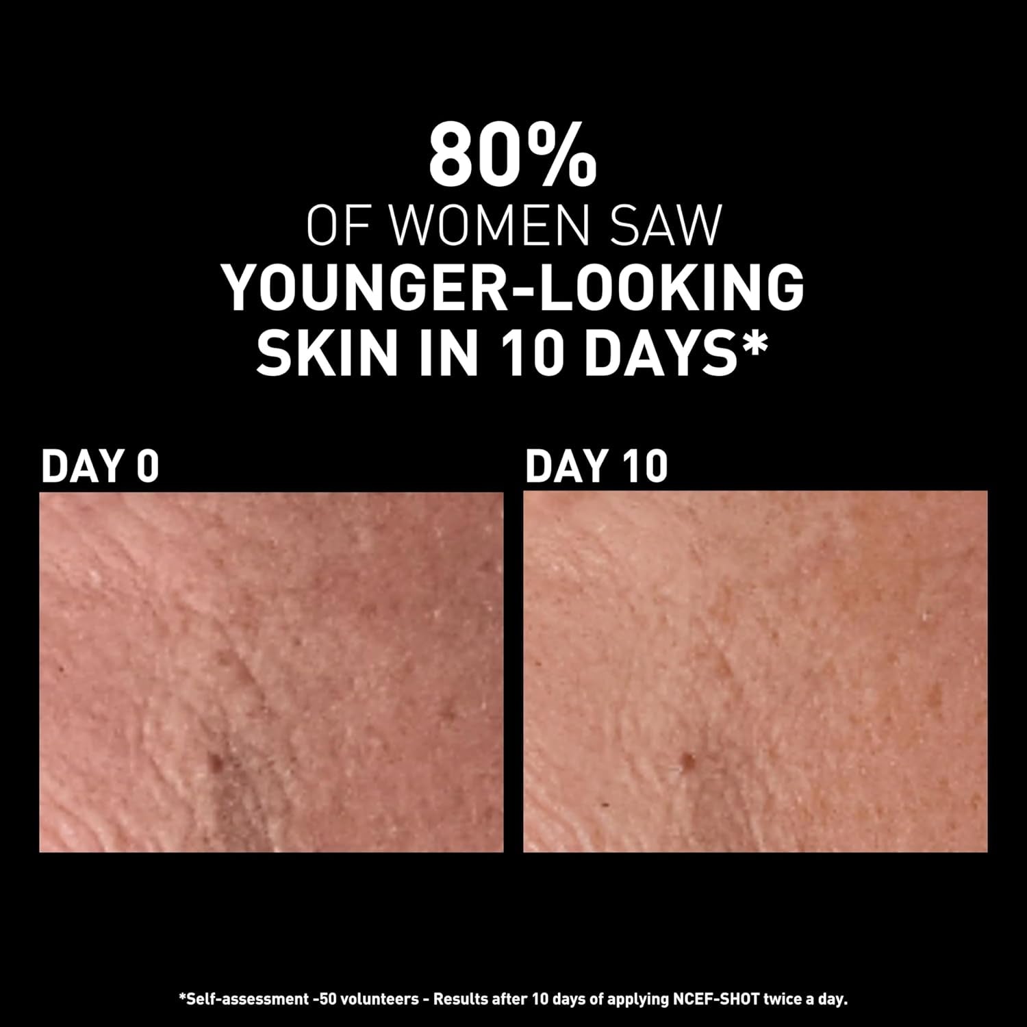 Ncef-Shot Anti-Aging Serum: Intensive Wrinkle Reduction Treatment for Radiant and Firm Skin in Just 10 Days, 0.5 Fl. Oz.