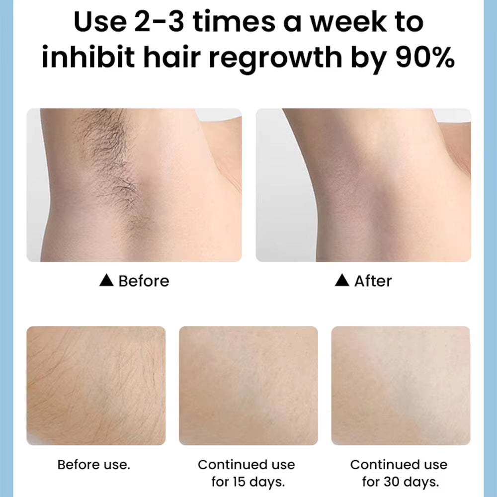 Professional IPL Hair Removal Kit for Women - Portable Laser Device for Painless Bikini Hair Removal