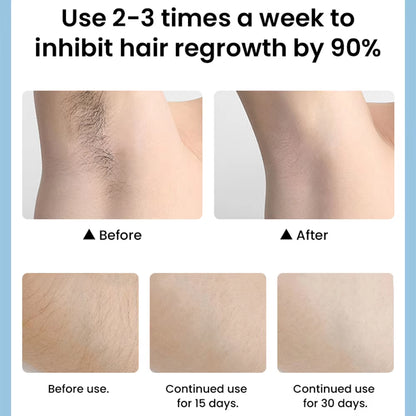 Professional IPL Hair Removal Kit for Women - Portable Laser Device for Painless Bikini Hair Removal